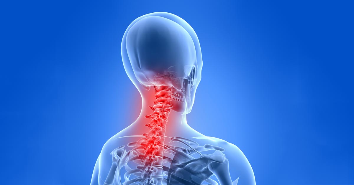 Napa car accident and neck pain treatment